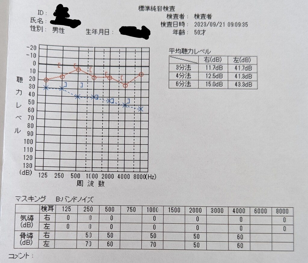 突発性難聴_初診_聴力検査