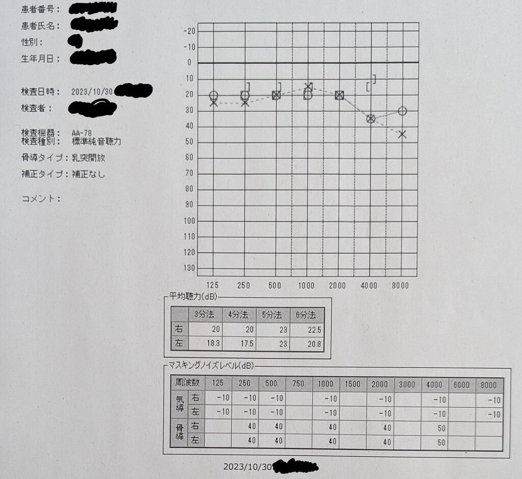 某大学病院の耳鼻咽喉科で４回の鼓室内注射の治療成果を聴力検査で測る